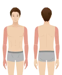 腕脱毛