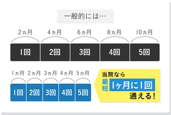 脱毛完了までのイメージ図
