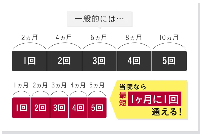 脱毛完了までのイメージ図