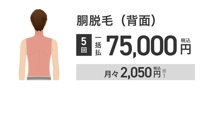 エミナルクリニックメンズの胴脱毛（背面）5回75,000円