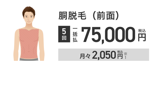 エミナルクリニックメンズの胴脱毛（前面）5回75,000円
