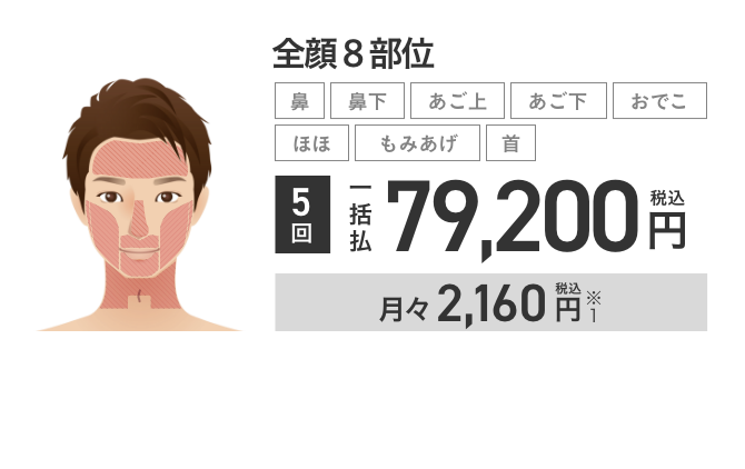 エミナルクリニックメンズの顔脱毛 (全顔8部位)5回79,200円