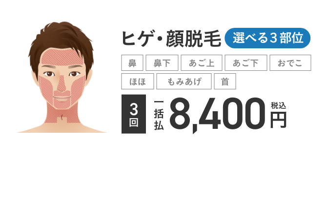 エミナルクリニックメンズのヒゲ脱毛 (3部位)3回8,400円