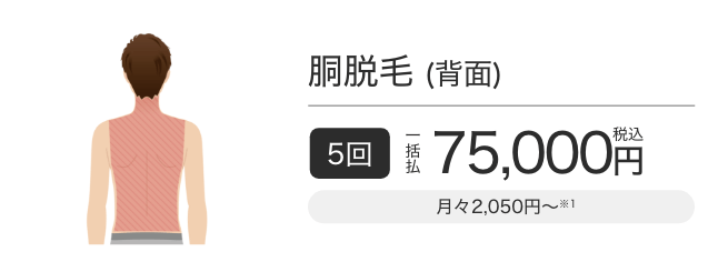 胴脱毛(背面) 5回一括払税込75,000円
