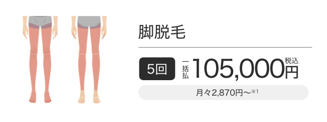 脚脱毛 5回一括払税込105,000円