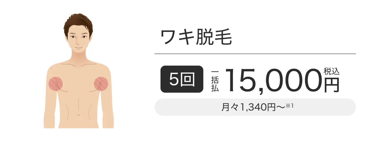 ワキ脱毛 5回一括払税込15,000円