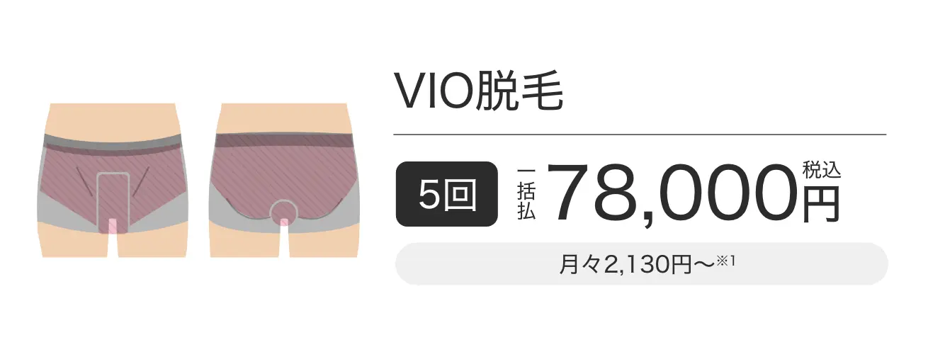 VIO脱毛 5回一括払税込78,000円