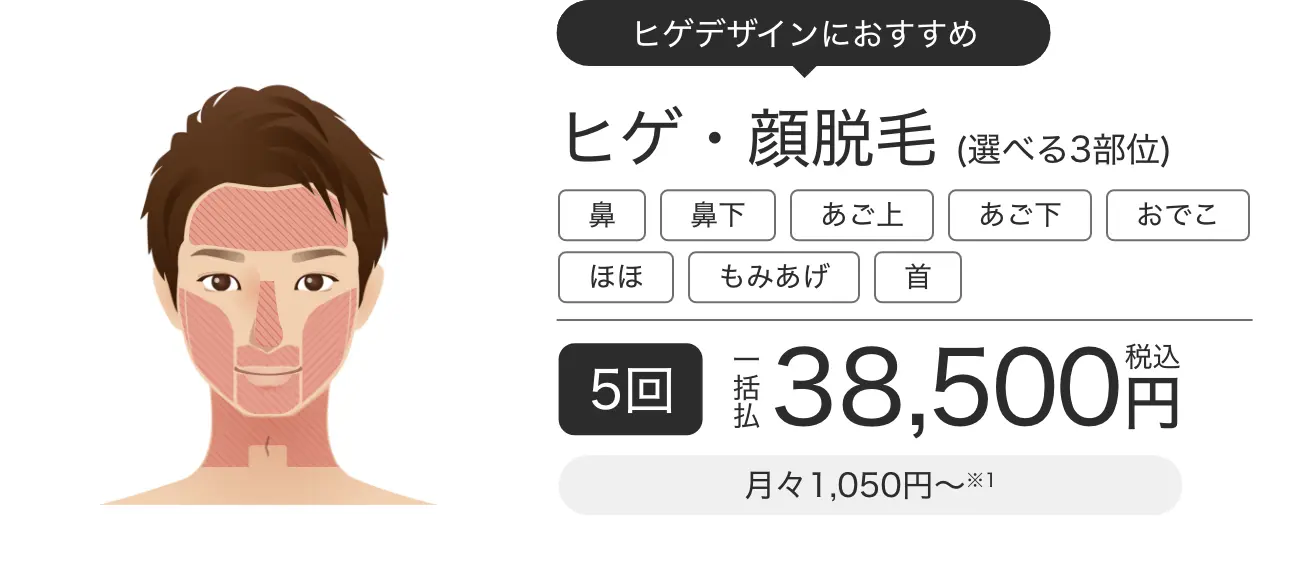 ヒゲ脱毛・顔脱毛選べる3部位5回一括払税込38,500円