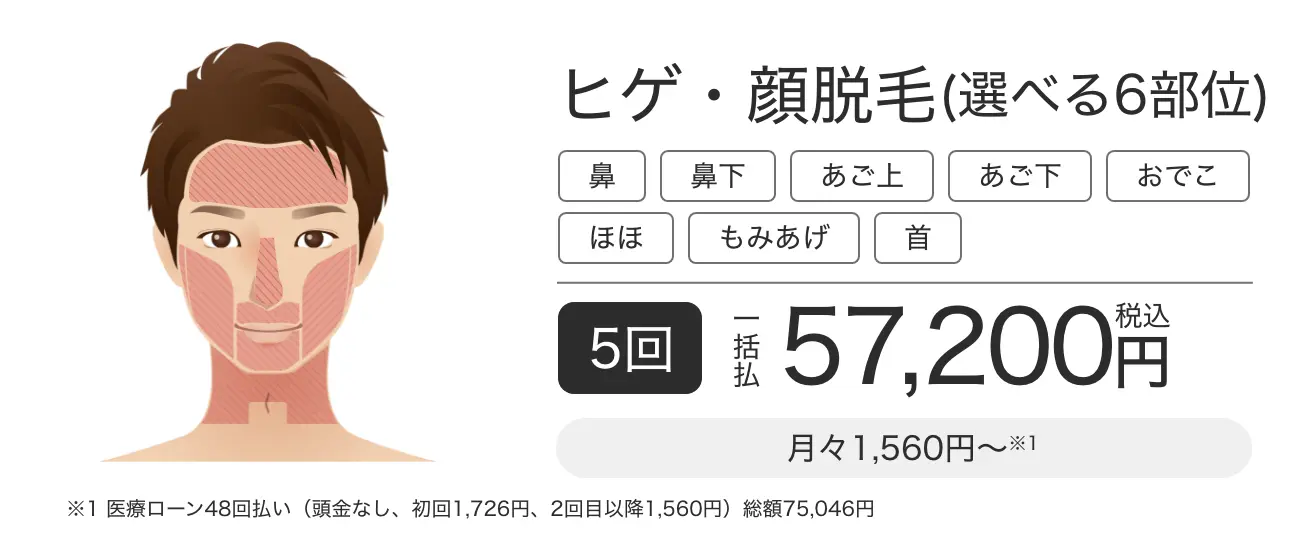 ヒゲ脱毛・顔脱毛(選べる6部位) 5回 一括払税込57,200円