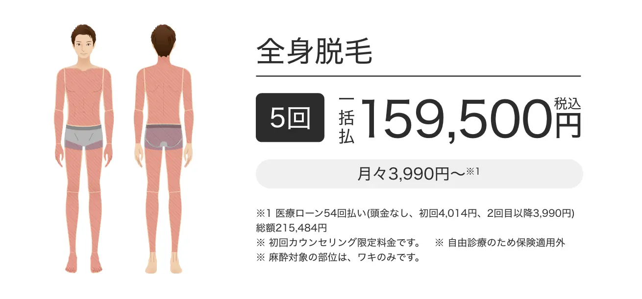 全身脱毛 5回 一括払 税込159,500円