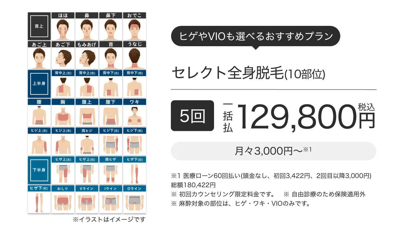 セレクト全身脱毛(10部位) 5回一括払 税込129,800円